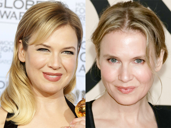 Renee-Zellweger-Plastic-Surgery-Before-After-Photos